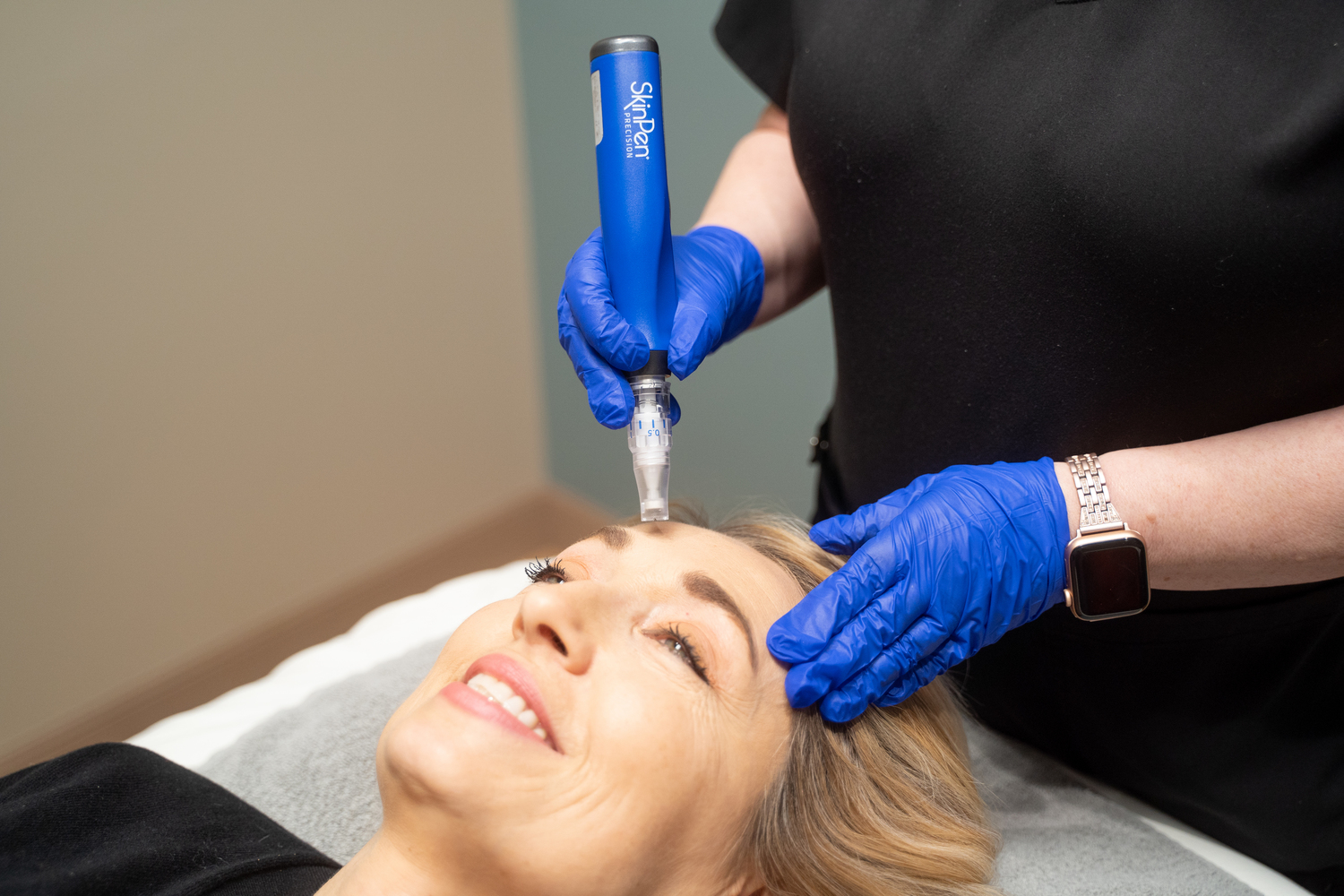 skin pen being used on patient