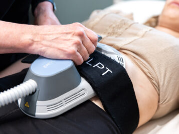 emsculpt treatment on womens abdomen