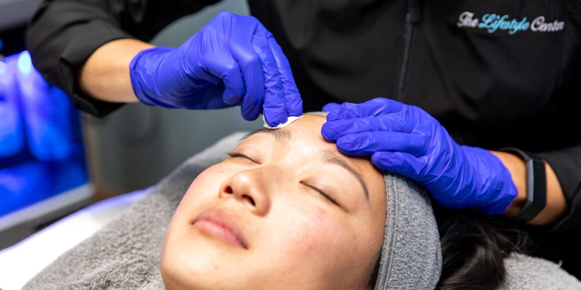 woman getting chemical peel at the lifestyle center