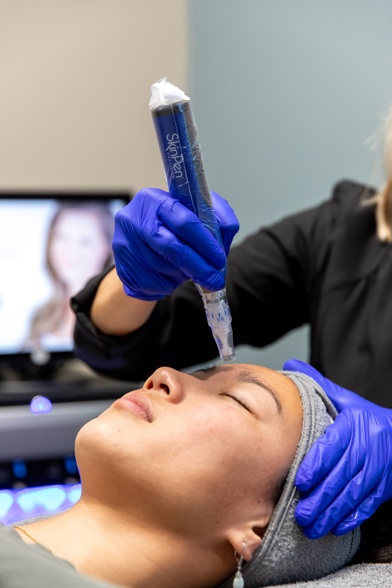 skin pen being used on patient