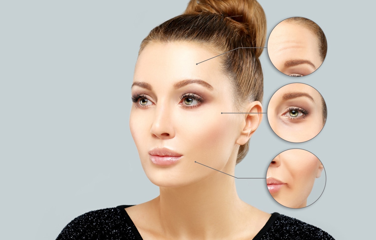 diagram showing where you can get botox