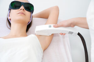 Laser hair removal