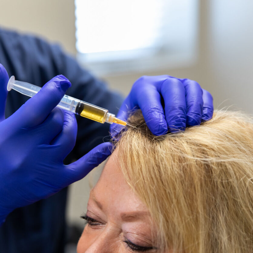 Provider administering a PRP scalp injection for hair restoration treatment at a medical aesthetics clinic.